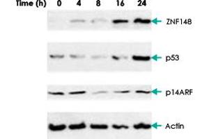 Western blot analysis of AGS (gastric carcinoma) cells with ZNF148 polyclonal antibody . (ZNF148 抗体)
