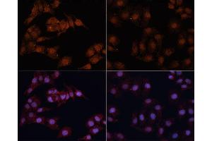 Immunofluorescence (IF) image for anti-Microtubule-Associated Protein 1 Light Chain 3 beta (MAP1LC3B) antibody (ABIN6567107)