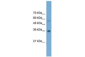 GALE antibody used at 0. (GALE 抗体  (Middle Region))