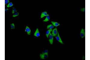 Immunofluorescence staining of Hela cells with ABIN7168827 at 1:133, counter-stained with DAPI. (SEMA6D 抗体  (AA 913-1068))