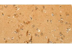 Immunohistochemistry of paraffin-embedded Human brain using CFHR1 Polyclonal Antibody at dilution of 1:40 (CFHR1 抗体)