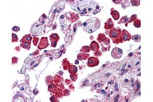 Anti-NLRP13 antibody IHC of human lung. (NLRP13 抗体  (N-Term))