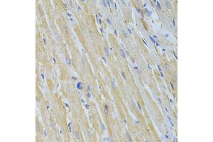 Immunohistochemistry of paraffin-embedded rat heart using NME1 Antibody (ABIN5970089) at dilution of 1/200 (40x lens). (NME1 抗体  (C-Term))