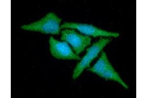 ICC/IF analysis of MAT2A in HeLa cells line, stained with DAPI (Blue) for nucleus staining and monoclonal anti-human MAT2A antibody (1:100) with goat anti-mouse IgG-Alexa fluor 488 conjugate (Green). (MAT2A 抗体  (AA 1-395))