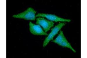 ICC/IF analysis of MAT2A in HeLa cells line, stained with DAPI (Blue) for nucleus staining and monoclonal anti-human MAT2A antibody (1:100) with goat anti-mouse IgG-Alexa fluor 488 conjugate (Green).