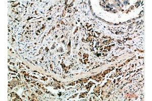 Immunohistochemistry (IHC) image for anti-Nanos Homolog 1 (NANOS1) (AA 151-200) antibody (ABIN7184522)