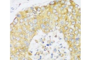 Immunohistochemistry (Paraffin-embedded Sections) (IHC (p)) image for anti-ER Lipid Raft Associated 1 (ERLIN1) antibody (ABIN7258170)
