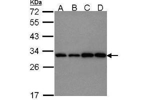 WB Image Sample (30 ug of whole cell lysate) A: 293T B: A431 , C: JurKat D: Raji 12% SDS PAGE antibody diluted at 1:1000 (PGAM1 抗体)