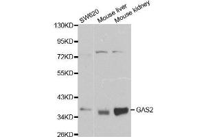 Western blot analysis of extracts of various cell lines, using GAS2 antibody. (GAS2 抗体  (AA 1-100))