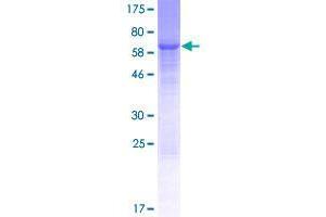 WDR73 Protein (AA 1-378) (GST tag)