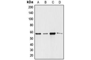 Western blot analysis of ANGPTL1 expression in SW620 (A), A549 (B), MCF7 (C), SGC (D) whole cell lysates. (ANGPTL1 抗体  (N-Term))