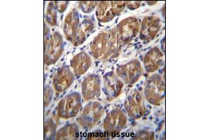Immunohistochemistry (Paraffin-embedded Sections) (IHC (p)) image for anti-Pepsinogen 4, Group I (Pepsinogen A) (PGA4) (AA 353-381), (C-Term) antibody (ABIN656949)