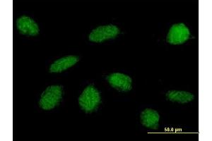 Immunofluorescence of purified MaxPab antibody to GLI4 on HeLa cell. (GLI4 抗体  (AA 1-376))