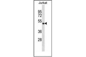 Western blot analysis of NBPF5 Antibody (C-term) in Jurkat cell line lysates (35ug/lane). (NBPF5 抗体  (C-Term))