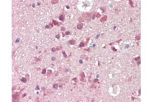 Anti-SLC38A2 / SNAT2 antibody IHC staining of human brain, cortex. (SLC38A2 抗体  (AA 35-84))