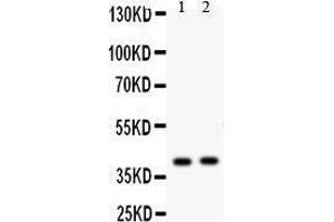 Anti- NDRG2 antibody, Western blotting All lanes: Anti NDRG2  at 0. (NDRG2 抗体  (C-Term))