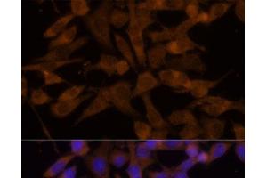 Immunofluorescence analysis of HeLa cells using UGT2B7 Polyclonal Antibody at dilution of 1:100 (40x lens). (UGT2B7 抗体)