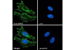 (ABIN185584) Immunofluorescence analysis of paraformaldehyde fixed HeLa cells, permeabilized with 0.
