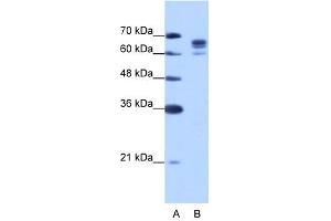DDX17 antibody used at 1. (DDX17 抗体)