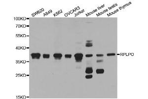 Western Blotting (WB) image for anti-Ribosomal Protein, Large, P0 (RPLP0) antibody (ABIN1876737) (RPLP0 抗体)