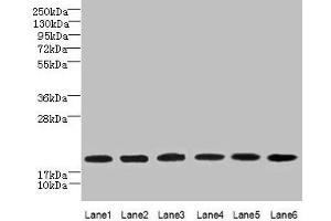 Western blot All lanes: SPATA19 antibody at 1 μg/mL Lane 1: MCF-7 whole cell lysate Lane 2: Hela whole cell lysate Lane 3: HepG2 whole cell lysate Lane 4: MDA-MB-231 whole cell lysate Lane 5: A549 whole cell lysate Lane 6: Mouse liver tissue Secondary Goat polyclonal to rabbit IgG at 1/10000 dilution Predicted band size: 20 kDa Observed band size: 20 kDa (SPATA19 抗体  (AA 25-167))