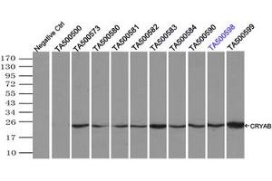 Image no. 4 for anti-Crystallin, alpha B (CRYAB) antibody (ABIN1497646) (CRYAB 抗体)