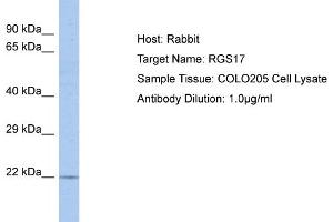 Host: Rabbit Target Name: RGS17 Sample Tissue: Human COLO205 Whole Cell Antibody Dilution: 1ug/ml
