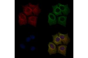 ABIN6255701 and ABIN6267554 staining HepG2 cells(30 min of 4uM Forskolin treatment) by IF/ICC. (LIM Domain Kinase 1 抗体  (pThr508))