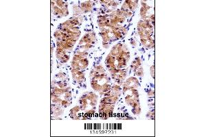 Immunohistochemistry (IHC) image for anti-General Transcription Factor IIE, Polypeptide 1, alpha 56kDa (GTF2E1) (AA 93-121), (N-Term) antibody (ABIN5536203)