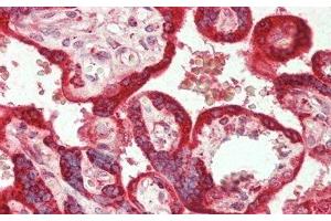 Immunohistochemistry (IHC) image for anti-Interleukin 1 Receptor-Like 1 (IL1RL1) (AA 162-349) antibody (ABIN7437368)