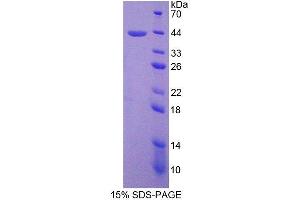 SDS-PAGE analysis of Human SPD Protein. (SFTPD 蛋白)