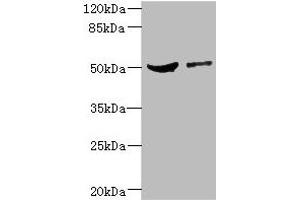 Western blot All lanes: CPN1 antibody at 6. (CPN1 抗体  (AA 209-458))