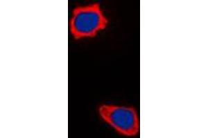 Immunofluorescent analysis of COX17 staining in HepG2 cells. (COX17 抗体  (N-Term))