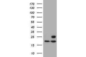 Western Blotting (WB) image for anti-Proteasome (Prosome, Macropain) Subunit, beta Type, 9 (Large Multifunctional Peptidase 2) (PSMB9) (AA 21-219) antibody (ABIN1491194) (PSMB9 抗体  (AA 21-219))
