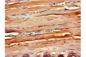 Immunohistochemistry of paraffin-embedded human skeletal muscle tissue using ABIN7145918 at dilution of 1:100 (CCR1 抗体  (AA 314-362))