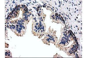 Immunohistochemical staining of paraffin-embedded Human prostate tissue using anti-FAM40A mouse monoclonal antibody. (STRIP1 抗体)