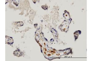Immunoperoxidase of monoclonal antibody to MKNK1 on formalin-fixed paraffin-embedded human placenta. (MKNK1 抗体  (AA 1-465))