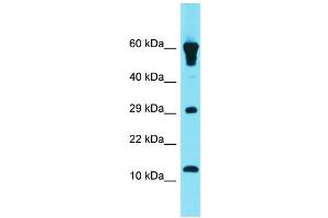 Host: Rabbit Target Name: GCSAML Sample Type: Fetal Heart lysates Antibody Dilution: 1. (GCSAML 抗体  (N-Term))