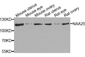Western blot analysis of extracts of various cells, using NAA25 antibody. (NAA25 抗体)