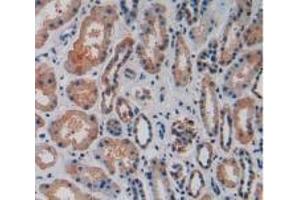 Detection of VCAM1 in Human Kidney Tissue using Polyclonal Antibody to Vascular Cell Adhesion Molecule 1 (VCAM1) (VCAM1 抗体  (AA 109-318))