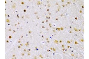 Immunohistochemistry (IHC) image for anti-Inhibitor of kappa Light Polypeptide Gene Enhancer in B-Cells, Kinase beta (IKBKB) (AA 630-730) antibody (ABIN3022876)