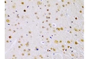 Immunohistochemistry of paraffin-embedded mouse brain using IKKβ antibody (ABIN3022875, ABIN3022876, ABIN3022877 and ABIN6219275) at dilution of 1:100 (40x lens). (IKBKB 抗体  (AA 630-730))