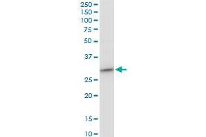 CYB5R3 polyclonal antibody (A01), Lot # AUL1060606QCS1. (CYB5R3 抗体  (AA 1-301))