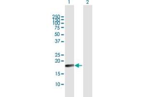 Western Blot analysis of TNFSF18 expression in transfected 293T cell line by TNFSF18 MaxPab polyclonal antibody. (TNFSF18 抗体  (AA 1-177))
