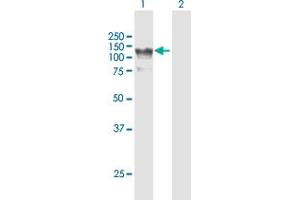 Western Blot analysis of HIP1R expression in transfected 293T cell line by HIP1R MaxPab polyclonal antibody. (HIP1R 抗体  (AA 1-1068))