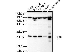 Western blot analysis of extracts of various cell lines, using RhoB Rabbit pAb antibody (ABIN3016775, ABIN3016776, ABIN3016777 and ABIN6219838) at 1:1000 dilution. (RHOB 抗体  (C-Term))
