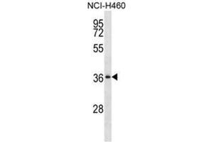 Western blot analysis of SERPINB1 Antibody (Center) Cat.