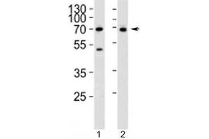 Western blot analysis of lysate from 1) Jurkat and 2) SK-BR-3 cell line using CD46 antibody at 1:1000. (CD46 抗体  (AA 317-343))