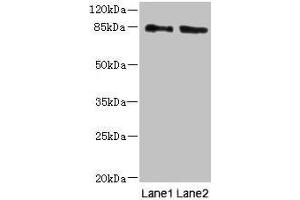 Western blot All lanes: HOOK1 antibody at 4 μg/mL Lane 1: 293T whole cell lysate Lane 2: MCF-7 whole cell lysate Secondary Goat polyclonal to rabbit IgG at 1/10000 dilution Predicted band size: 85, 81 kDa Observed band size: 85 kDa (HOOK1 抗体  (AA 301-600))