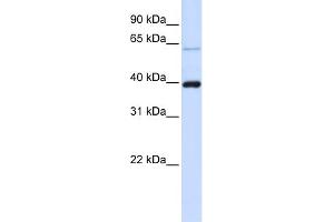 WB Suggested Anti-PHF6 Antibody Titration:  0. (PHF6 抗体  (C-Term))